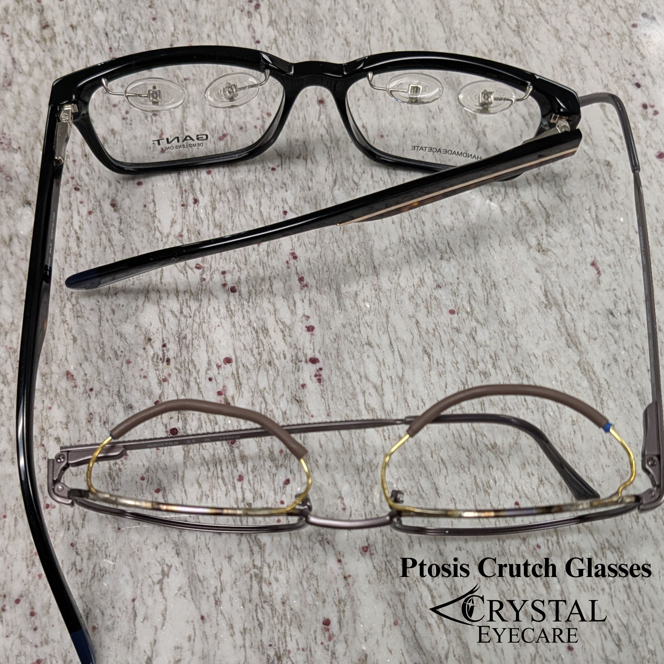 Custom ptosis crutch eyewear modification designed to support a drooping upper eyelid
