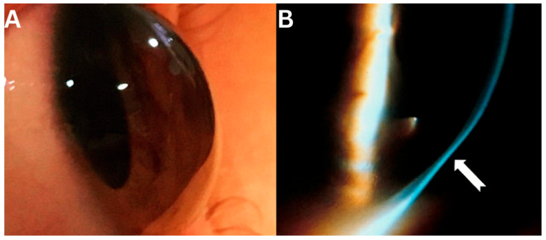 photo by Michael Tsatsos et al.